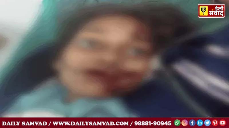 Anshu in injured condition in the hospital.