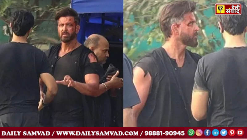 Hrithik Injured during Shooting