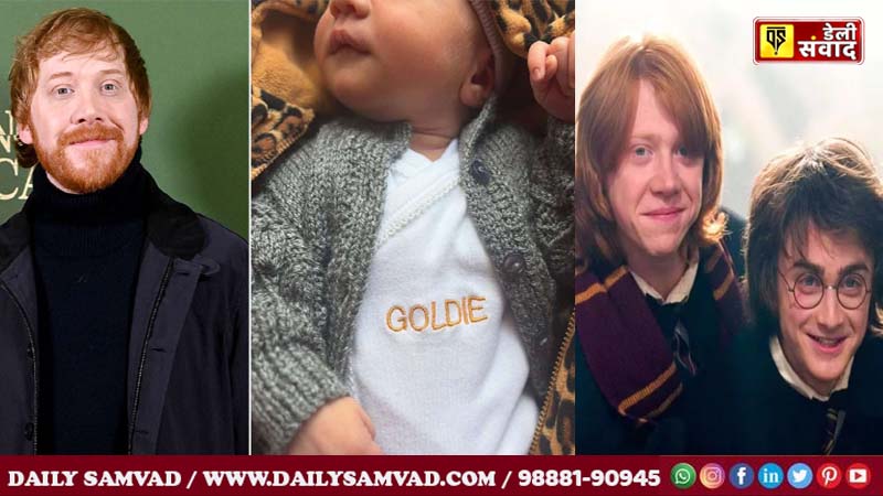 Harry Potter Fame Rupert Grint baby