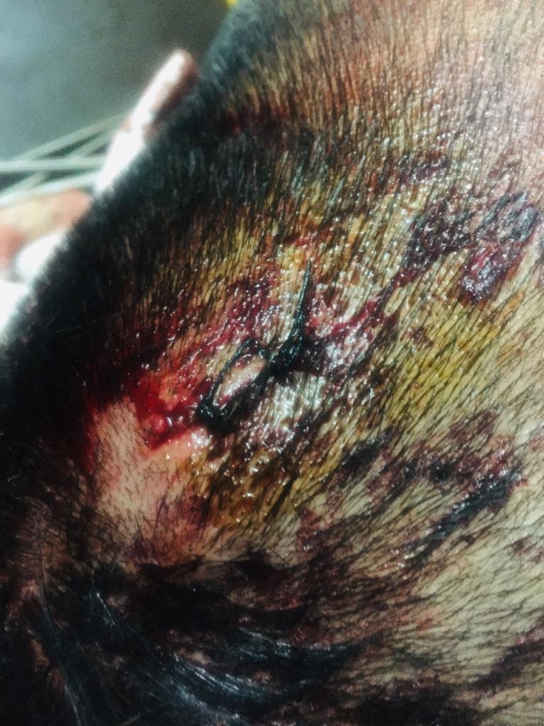 जालंधर: पूर्व मंत्री के गनर के घर बदमाशों का हमला, गाड़ी और घर पर पथराव, धरदार हथियार से गनर का सिर फाड़ा, शिकायत के बाद भी पुलिस ने नहीं की कोई कार्रवाई, देखें Video