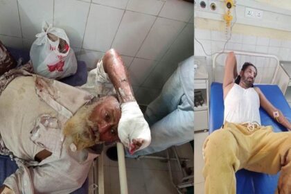 Punjab News: पंजाब के मोगा में अंतिम संस्कार के वक्त ब्लास्ट, 30 से ज्यादा घायल, कईयों की हालत नाजुक