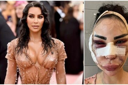 Kim Kardashian की तरह दिखने के लिए मॉडल ने करवाई 40 सर्जरी, 12 साल में फूंके 4 करोड़