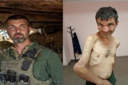 Ukraine and Russia War: रूस ने कैसा किया एक यूक्रेन सैनिक का हाल, देखिये तस्वीरें