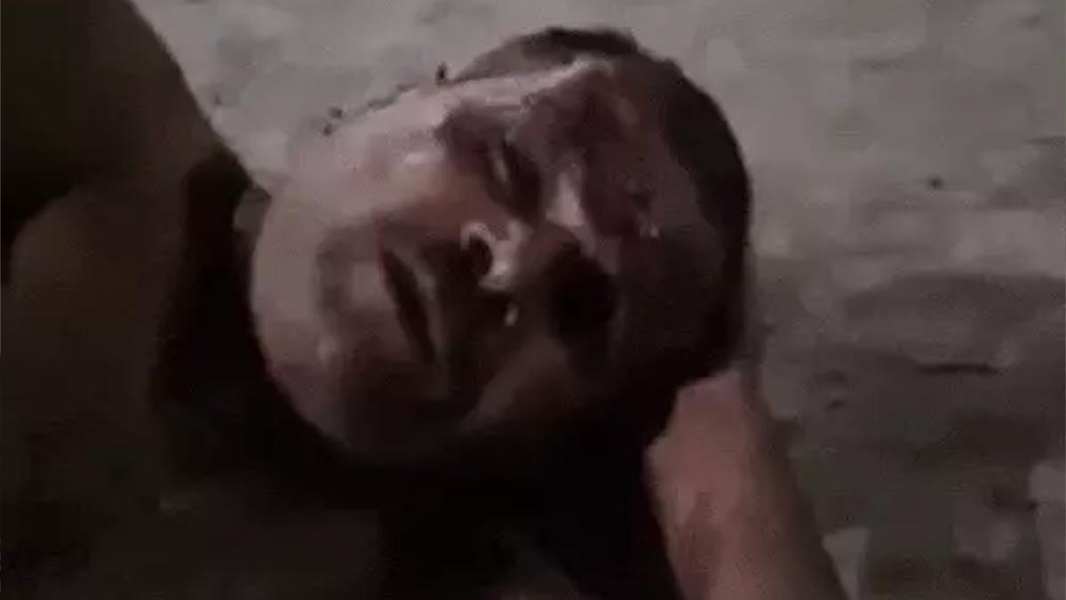 The injured person giving information about the incident