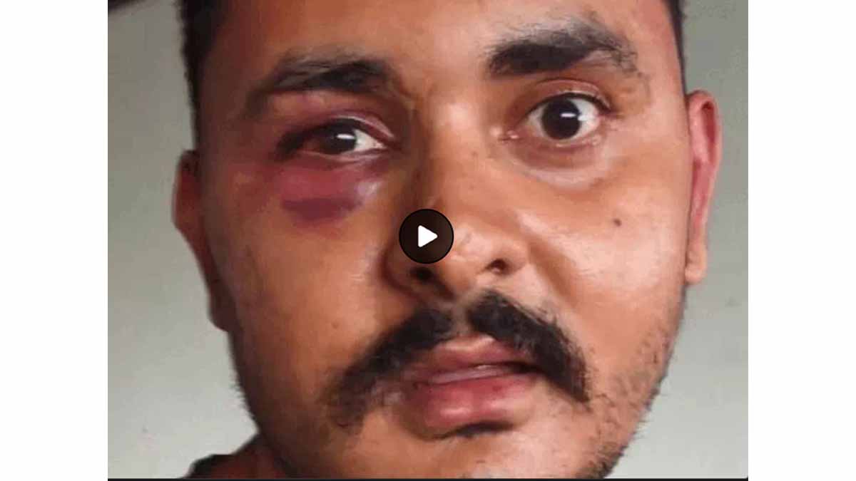 Accused Ganesh Bhatt