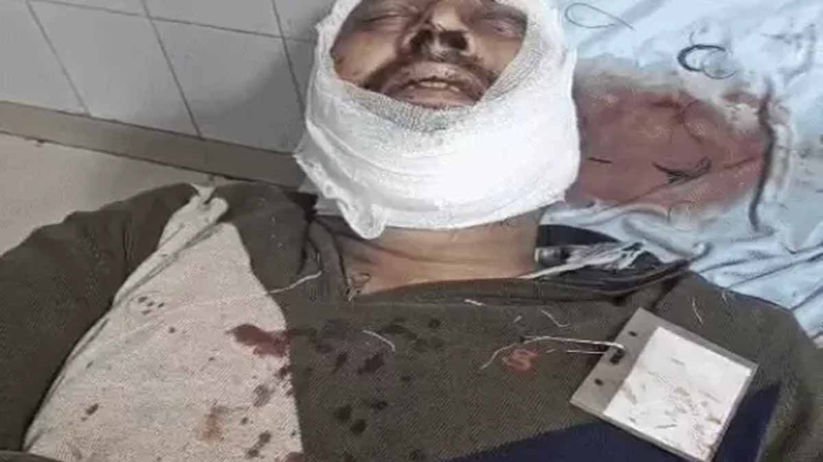 Guard Gurmukh needed 25 stitches for a broken leg